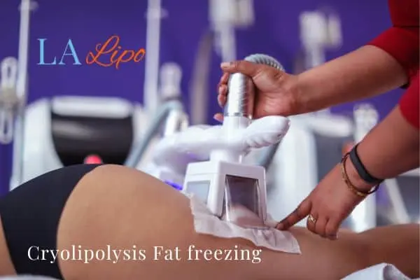 women getting fat freezing North Harrow
